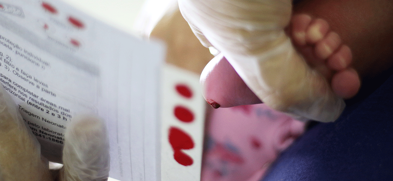 Teste do pezinho pelo SUS no ES passa a detectar AME e outras doenças raras